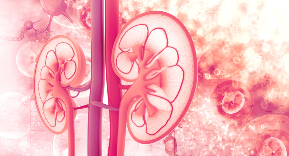 kidney stone